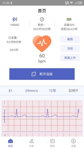 联影小智健康  v1.9.4图3